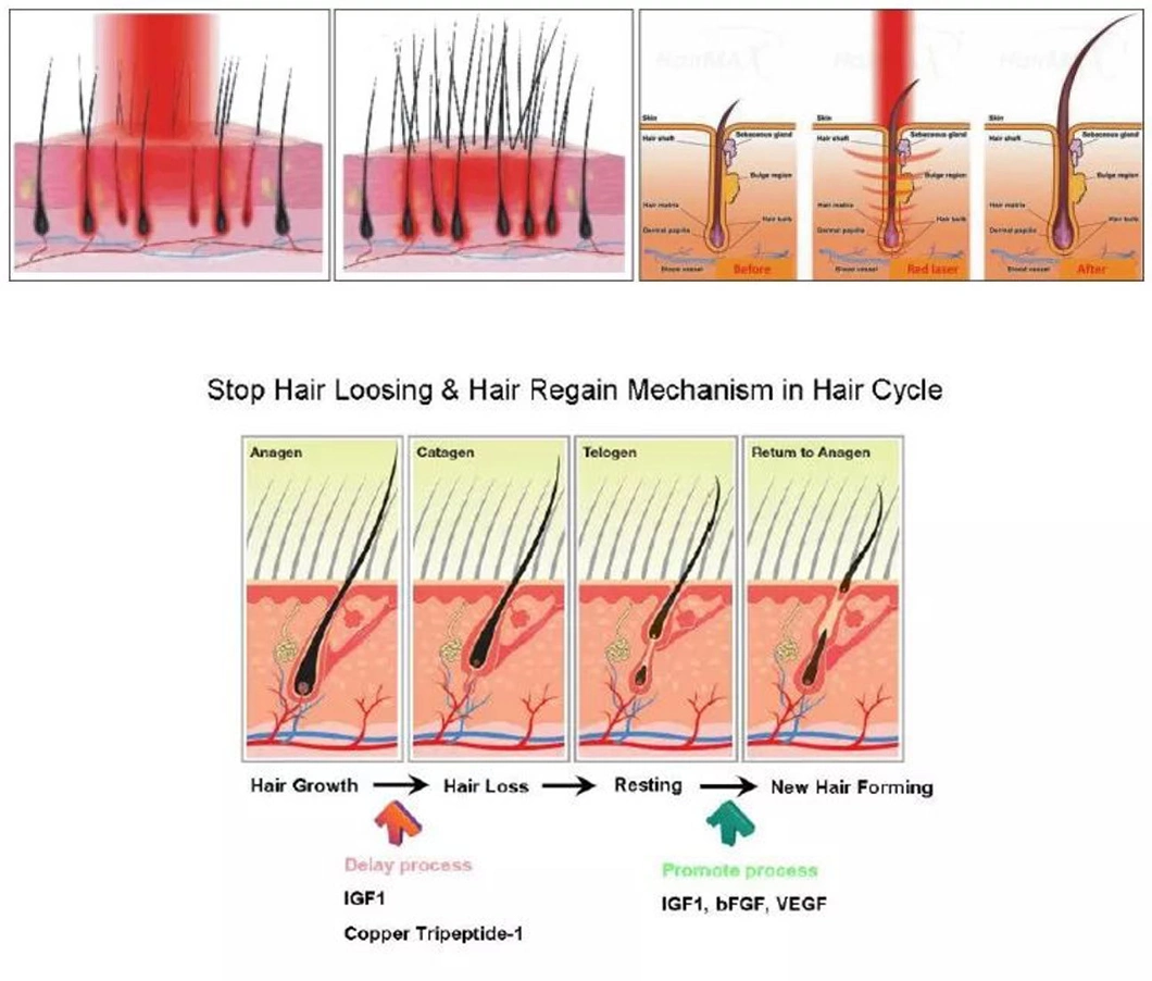Professional Anti Hair Loss Treatment Diode Laser Hair Regrowth Machine