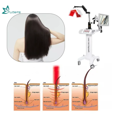 650nm Diode Laser Hair Regrowth Machine Anti Hair Loss Treatment